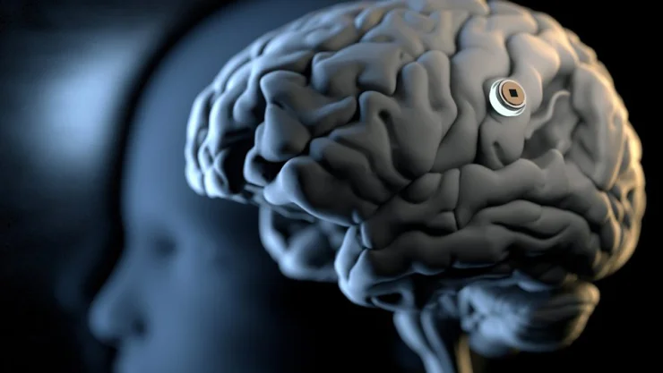 Trung Quốc tham vọng "lật đổ" Neuralink với công nghệ cấy chip não trong 10 phút