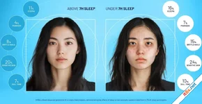 Ngoại hình thay đổi thế nào nếu thiếu ngủ