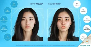 Ngoại hình thay đổi thế nào nếu thiếu ngủ