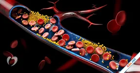 Những loại lá giúp giảm cholesterol, tốt cho tim mạch