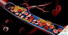Những loại lá giúp giảm cholesterol, tốt cho tim mạch