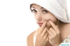 Nhìn mặt đoán bệnh qua các dấu hiệu cảnh báo trên khuôn mặt