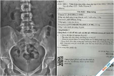 Cái giá của lối sống 'còn trẻ thì phải cày'