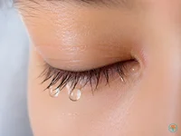 Dấu hiệu bất thường ở mắt cảnh báo bệnh lý tuyến giáp